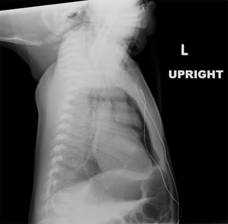 chest x-ray image left side